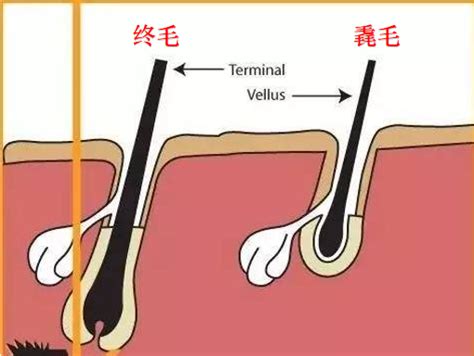 癦生毛|毳毛